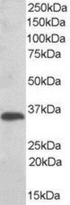 Western Blot: TXNDC Antibody [NB300-995]