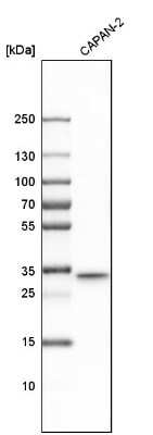 Western Blot: TXNDC Antibody [NBP1-87306]