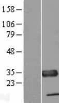 Western Blot: TXNDC Overexpression Lysate [NBL1-17463]