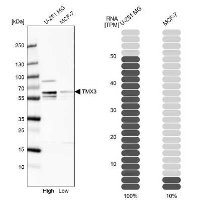 Western Blot: TXNDC10 Antibody [NBP1-92550]