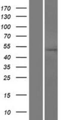 Western Blot: TXNDC10 Overexpression Lysate [NBP2-06738]