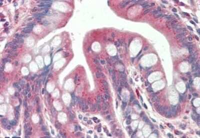 Immunohistochemistry-Paraffin: TXNDC11 Antibody [NBP1-78287]