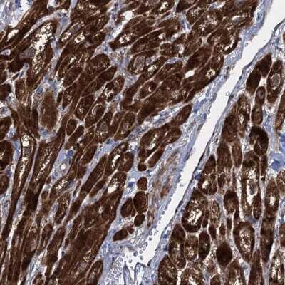 Immunohistochemistry-Paraffin: TXNDC11 Antibody [NBP1-83993]