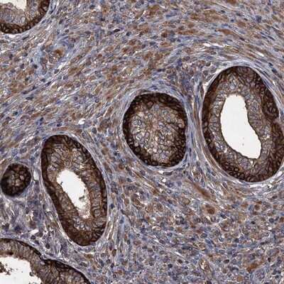Immunohistochemistry-Paraffin: TXNDC11 Antibody [NBP1-83994]
