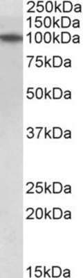 Western Blot: TXNDC11 Antibody [NBP1-78287]