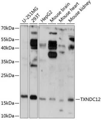 Western Blot: TXNDC12 AntibodyAzide and BSA Free [NBP2-93457]