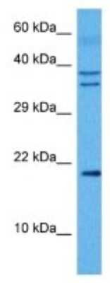 Western Blot: TXNDC12 Antibody [NBP3-10018]