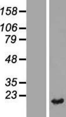 Western Blot: TXNDC12 Overexpression Lysate [NBL1-17465]