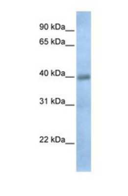 Western Blot: TXNDC15 Antibody [NBP1-69614]