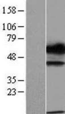 Western Blot: TXNDC15 Overexpression Lysate [NBL1-17468]