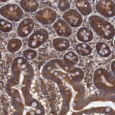 Immunohistochemistry-Paraffin: TXNDC16 Antibody [NBP1-93591]