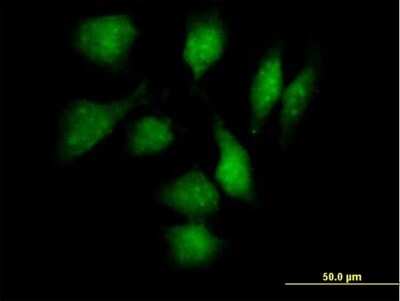 Immunocytochemistry/ Immunofluorescence: TXNDC3 Antibody [H00051314-B01P]