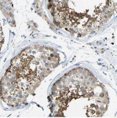 Immunohistochemistry-Paraffin: TXNDC3 Antibody [NBP1-85616]