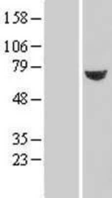 Western Blot: TXNDC3 Overexpression Lysate [NBL1-17470]