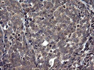Immunohistochemistry-Paraffin: TXNDC5 Antibody (OTI2E6) [NBP2-46256]