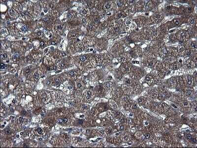 Immunohistochemistry-Paraffin: TXNDC5 Antibody (OTI2E6) [NBP2-46256]