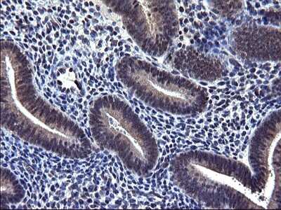 Immunohistochemistry-Paraffin: TXNDC5 Antibody (OTI2E6) [NBP2-46256]
