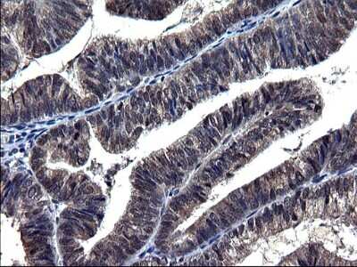Immunohistochemistry-Paraffin: TXNDC5 Antibody (OTI2E6) [NBP2-46256]