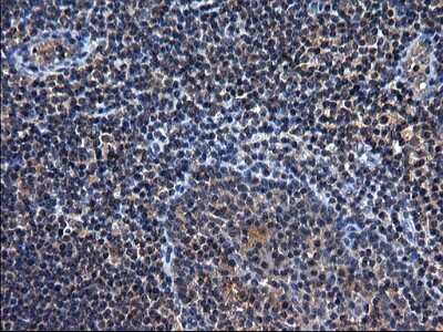 Immunohistochemistry-Paraffin: TXNDC5 Antibody (OTI2E6) [NBP2-46256]