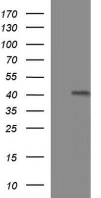 Western Blot: TXNDC5 Antibody (OTI2E6) [NBP2-46256]