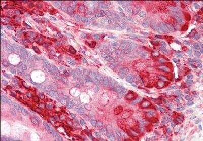 Immunohistochemistry-Paraffin: TXNDC5 Antibody [NB100-1452]