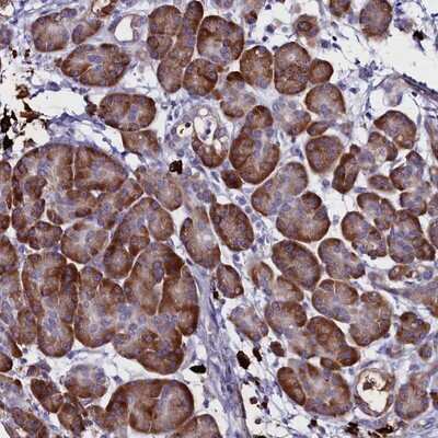 Immunohistochemistry-Paraffin: TXNDC5 Antibody [NBP2-13496]