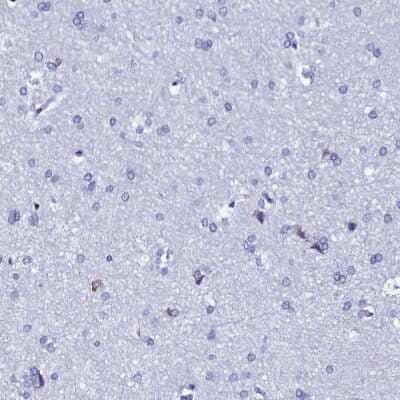 Immunohistochemistry-Paraffin: TXNDC5 Antibody [NBP2-13496]