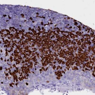 Immunohistochemistry-Paraffin: TXNDC5 Antibody [NBP2-13496]