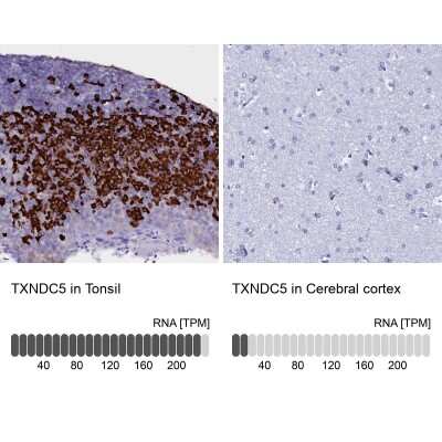 Immunohistochemistry-Paraffin: TXNDC5 Antibody [NBP2-13496]