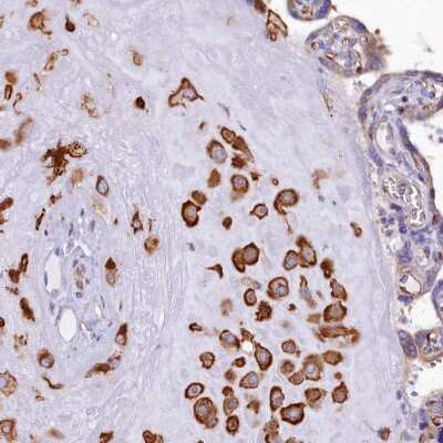 Immunohistochemistry-Paraffin: TXNDC5 Antibody [NBP2-13497]