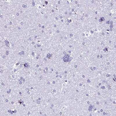 Immunohistochemistry-Paraffin: TXNDC5 Antibody [NBP2-13497]