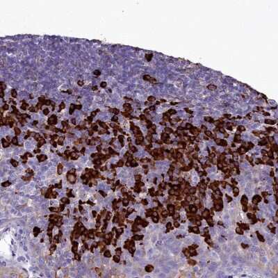 Immunohistochemistry-Paraffin: TXNDC5 Antibody [NBP2-13497]
