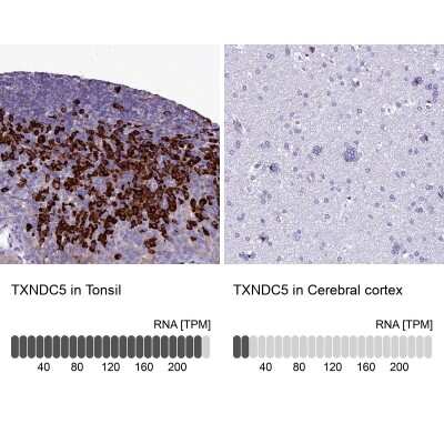 Immunohistochemistry-Paraffin: TXNDC5 Antibody [NBP2-13497]
