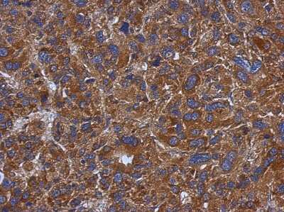 Immunohistochemistry-Paraffin: TXNDC5 Antibody [NBP2-20764]