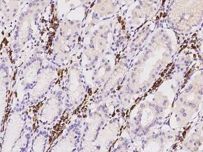 Immunohistochemistry-Paraffin: TXNDC5 Antibody [NBP2-98558]