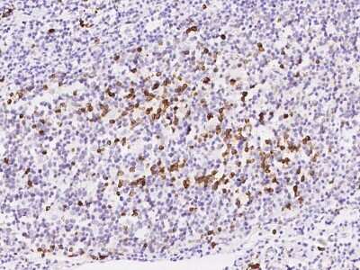 Immunohistochemistry-Paraffin: TXNDC5 Antibody [NBP2-98558]