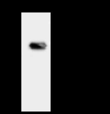 Immunoprecipitation: TXNDC5 Antibody [NBP2-98558]