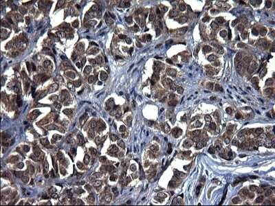 Immunohistochemistry: TXNDC5 Antibody (OTI2E6) - Azide and BSA Free [NBP2-74726]