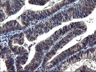 Immunohistochemistry: TXNDC5 Antibody (OTI2E6) - Azide and BSA Free [NBP2-74726]