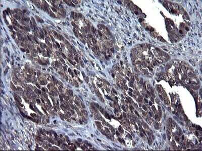 Immunohistochemistry: TXNDC5 Antibody (OTI2E6) - Azide and BSA Free [NBP2-74726]