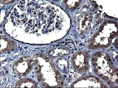 Immunohistochemistry: TXNDC5 Antibody (OTI2E6) - Azide and BSA Free [NBP2-74726]
