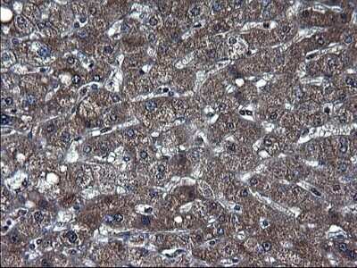 Immunohistochemistry: TXNDC5 Antibody (OTI2E6) - Azide and BSA Free [NBP2-74726]