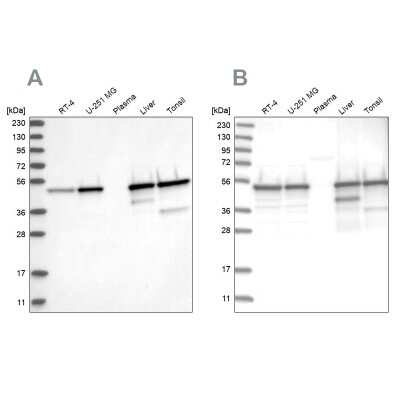 Western Blot: TXNDC5 Antibody [NBP2-13496]