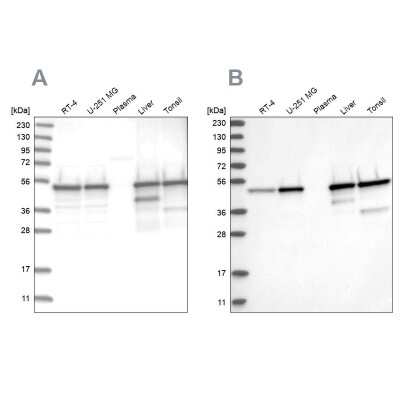 Western Blot: TXNDC5 Antibody [NBP2-13497]