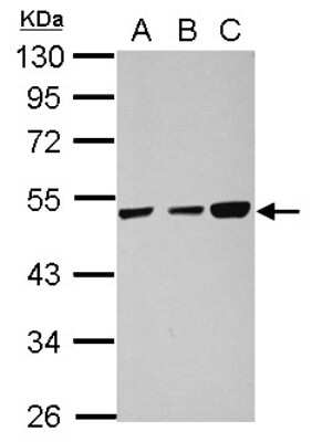 Western Blot: TXNDC5 Antibody [NBP2-20764]
