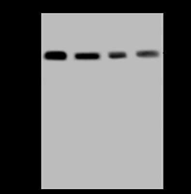 Western Blot: TXNDC5 Antibody [NBP2-98558]