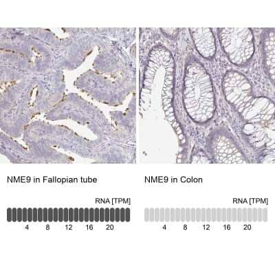 Immunohistochemistry-Paraffin: TXNDC6 Antibody [NBP2-48719]
