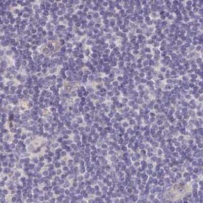 Immunohistochemistry-Paraffin: TXNDC6 Antibody [NBP2-48719]