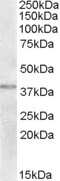 Western Blot: TXNDC6 Antibody [NBP1-20993]