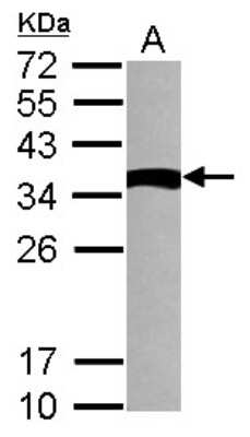 Western Blot: TXNDC6 Antibody [NBP2-15152]